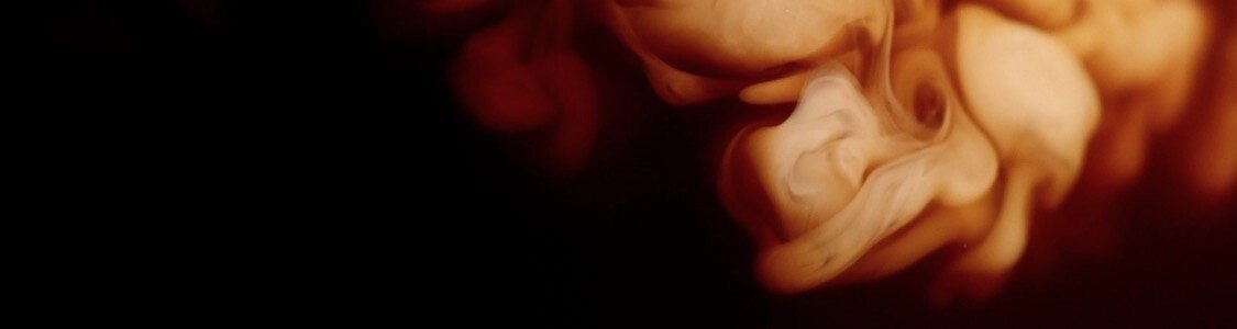 CAPPUCCINO E LATTE banner